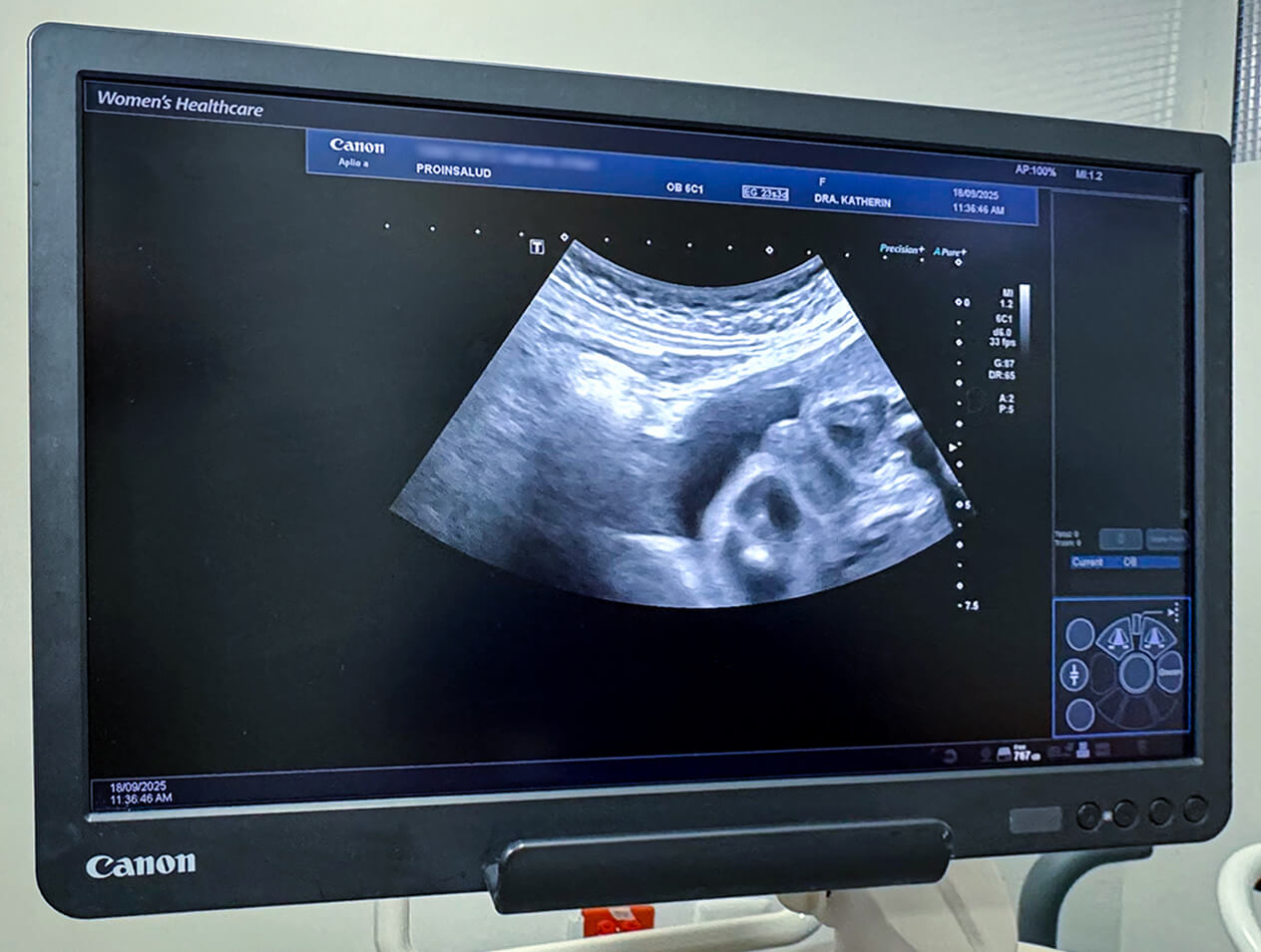 Proinsalud_resultados_Ecografía(1)